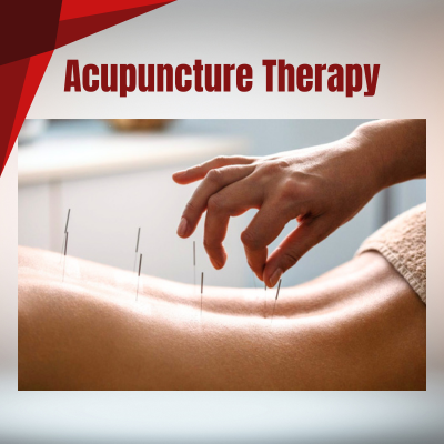 Acupunture Therapy