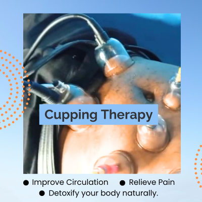 Cupping Therapy